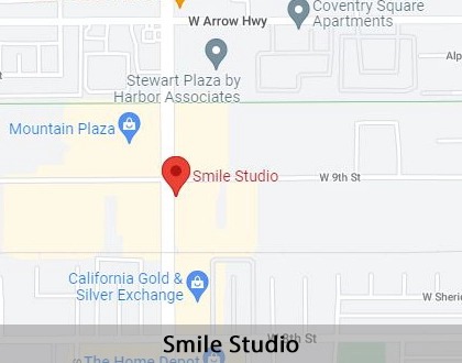 Map image for Emergency Dentist in Upland, CA